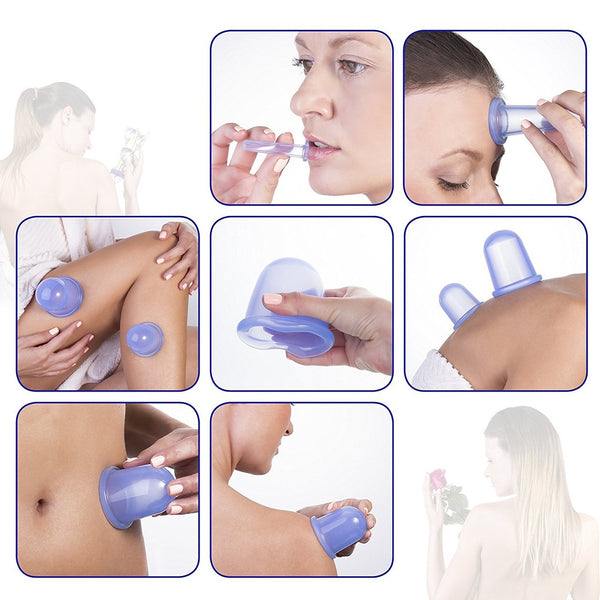 Silicone Cupping Set 4 Cups Blue 矽膠拔罐杯四入裝藍色